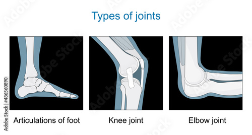 Knee joint, Articulations of foot, Elbow joint.
