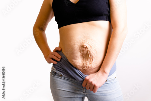cropped woman dressed in black top and blue jeans. Diastasis and umbilical hernia after pregnancy