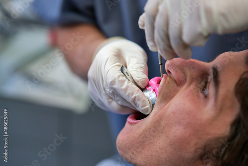 Tooth impression