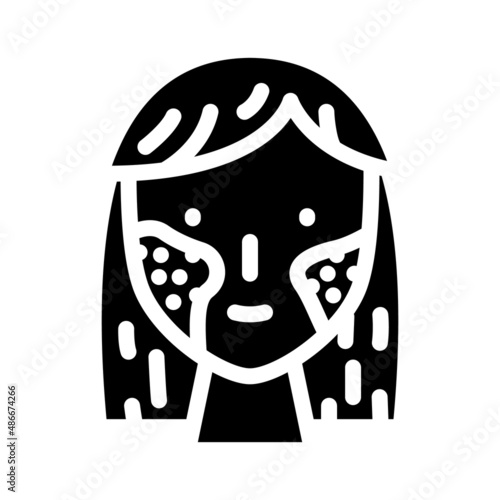 impetigo skin health problem glyph icon vector. impetigo skin health problem sign. isolated contour symbol black illustration