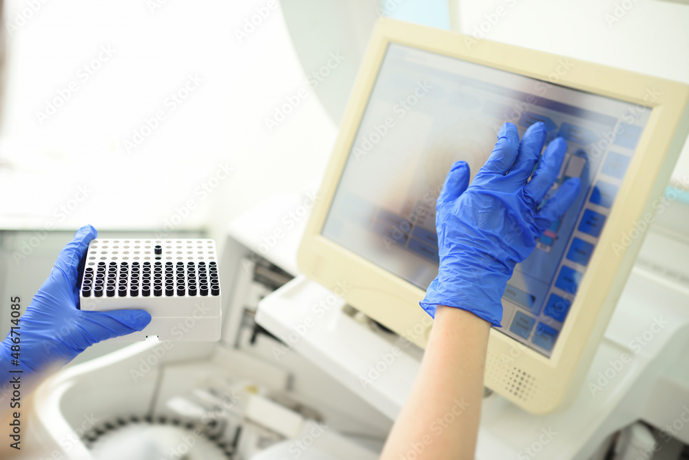 an employee of a medical bacteriological laboratory holds a container with test tubes in his hands against the background of the analyzer. an employee of a medical bacteriological laboratory holds a container with test tubes in his hands against the background of the analyzer.