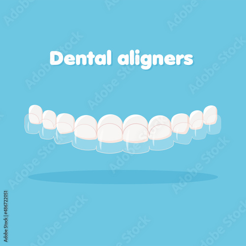 Mouth guard. Teeth with transparent braces. Alignment of teeth by aligners. Orthodontic dentistry concept. Dental care. Vector illustration isolated on blue background.	