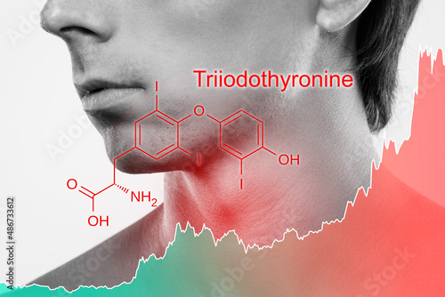 Male neck and chart of rising triiodothyronine hormone photo