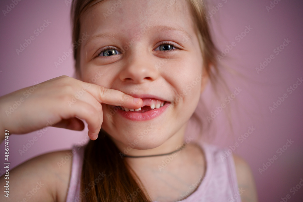 girl smiles without a front tooth. High quality photo girl smiles without a front tooth. High quality photo