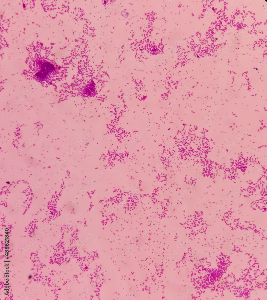 Microscopic view of Enterococcus bacteria from UTI patient urine sample