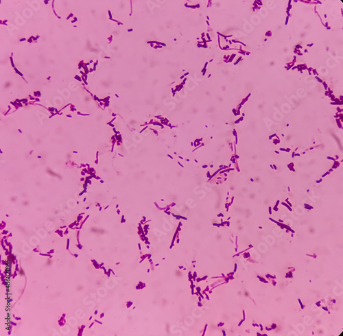 Fotografie Salmonellosis: microscopic view of gram stained slide from blood agar salmonella colonies, show Salmonella Typhi (S