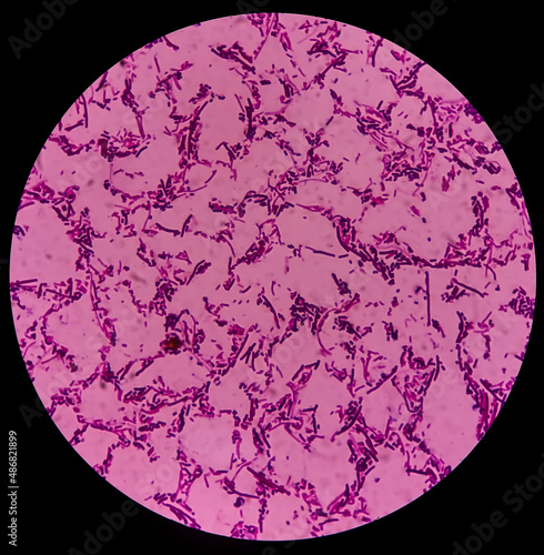 Salmonellosis: microscopic view of gram stained slide from blood agar salmonella colonies, show Salmonella Typhi (S. Typhi) bacteria, disease is referred to as typhoid fever. photo