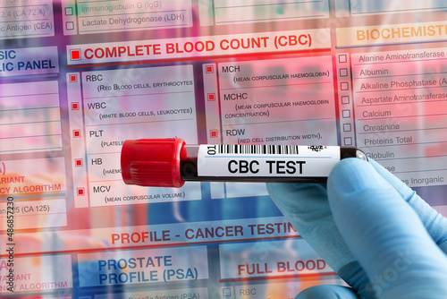 Blood tube test with requisition form for CBC Complete Blood Count test. Blood sample tube for analysis of FBC Full Complete Blood Count profile test in laboratory