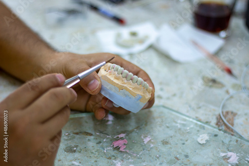 Fototapete denture making