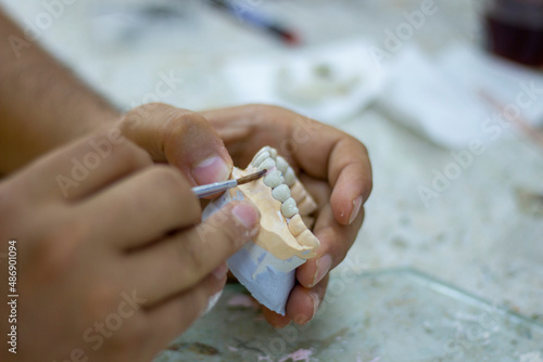 denture making