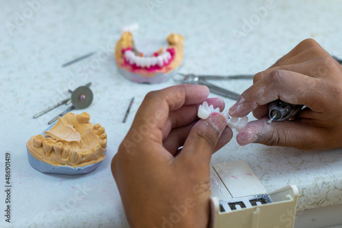 denture making
