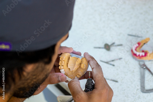 denture making