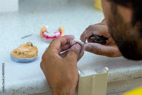denture making