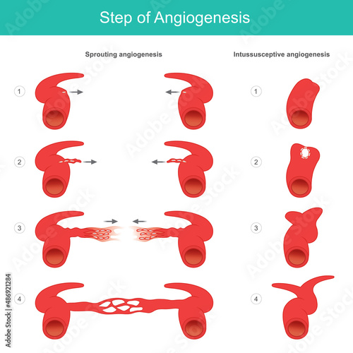 Step of Angiogenesis. Medical learning about the formation process of artery and capillary in human body. Illustration. photo