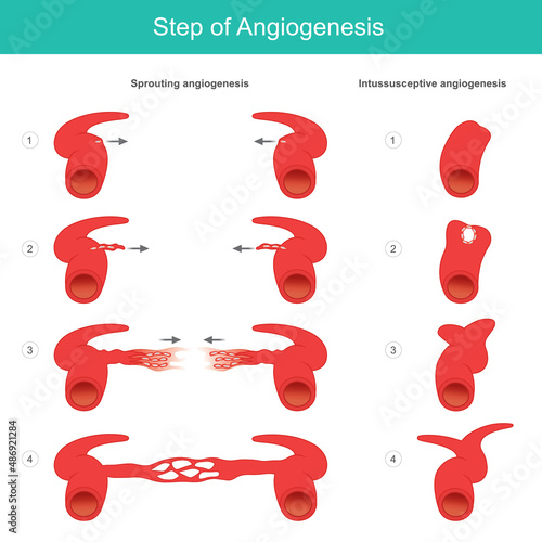 Step of Angiogenesis. Medical learning about the formation process of artery and capillary in human body. Illustration.
