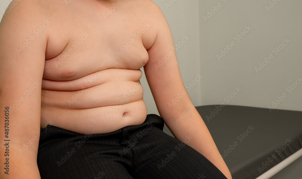 Fototapeta premium Folds on the belly of a fat boy. Obesity and excess weight concept. Tummy tuck, flabby skin on a fat belly, plastic surgery concept. Concept of excessive weight, obese, dieting and overweight