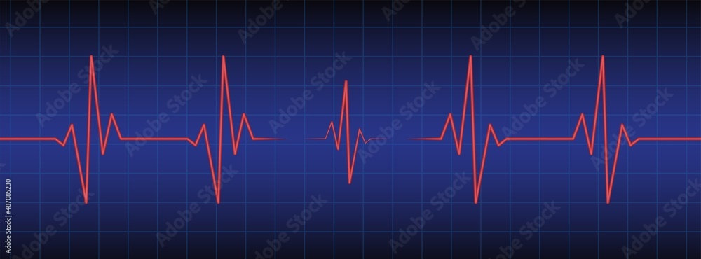 3d ecg, ekg monitor with cardio diagnosis. Heart rhythm line vector design to use in healthcare, healthy lifestyle, medicine, ekg, ecg concept illustration projects.