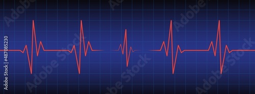 3d ecg, ekg monitor with cardio diagnosis. Heart rhythm line vector design to use in healthcare, healthy lifestyle, medicine, ekg, ecg concept illustration projects.
