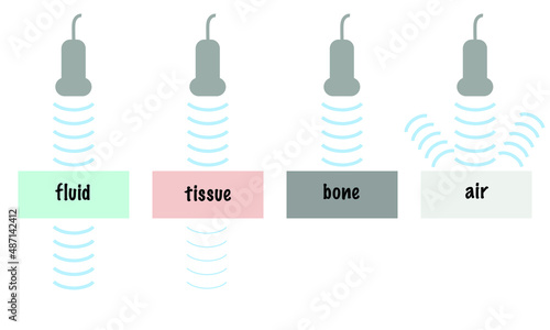 Ultrasound Wave Attenuation of Different Tissue Including Fluid Soft Tissue Bone Air