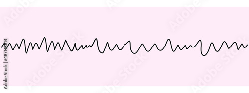 EKG monitoring Show Ventricular Fibrillation photo