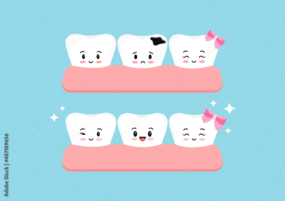 Cute teeth before and after decay in gym dental kids icon set isolated. Tooth kawaii character with dental caries hole treatment concept. Flat cartoon dentistry clip art vector illustration.