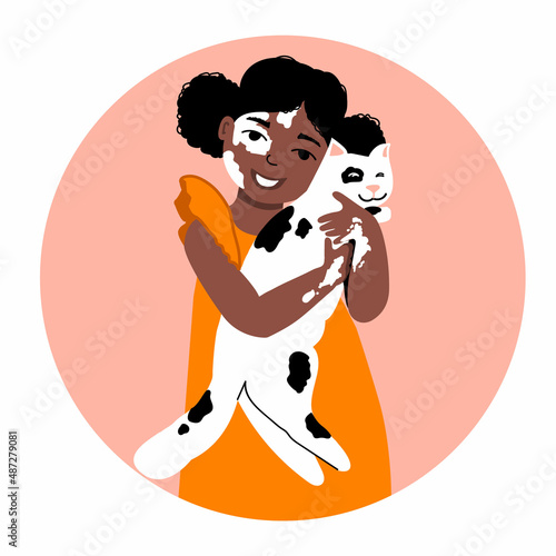 A cute girl with vitiligo, dark skin, black hair, holds a white spotted cat in her arms. Skin pigmentation problems. Take care of your health. Vector illustration