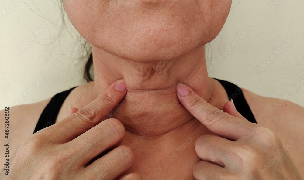 Close up portrait the hand holding the wrinkles flabbiness under the chin, concept health care. Close up portrait the hand holding the wrinkles flabbiness under the chin, concept health care.