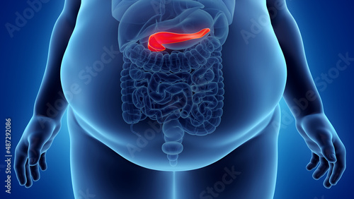 3d rendered illustration of an obese mans pancreas