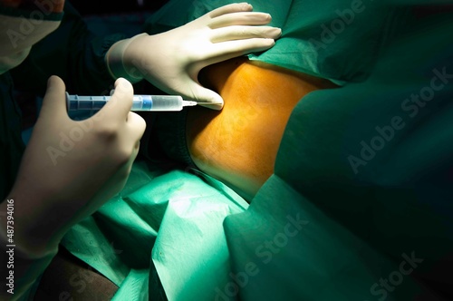 Foto Spinal nerve block