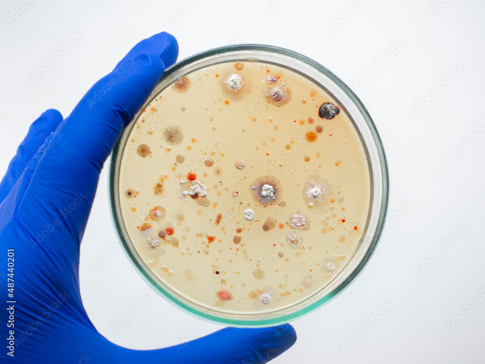 The blue hand of a scientist holds a petri dish with multi-colored colonies of bacteria on a white background, isolate, close-up. The blue hand of a scientist holds a petri dish with multi-colored colonies of bacteria on a white background, isolate, close-up.