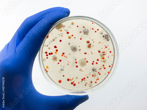 Fotografie A hand in a blue glove holds a cup with different red colonies of bacteria