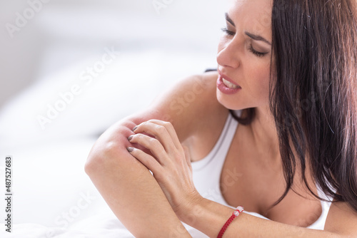 Intense scratching of arm by a woman who is itching from th erash or alergic reaction