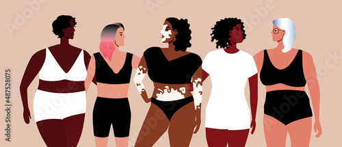 Multicultural women, different ages, ethnic group, Flat vector stock illustration, Inclusive people with vitiligo