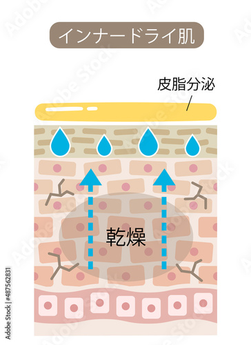 インナードライ　肌の断面図