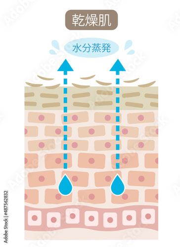 乾燥肌　断面図
