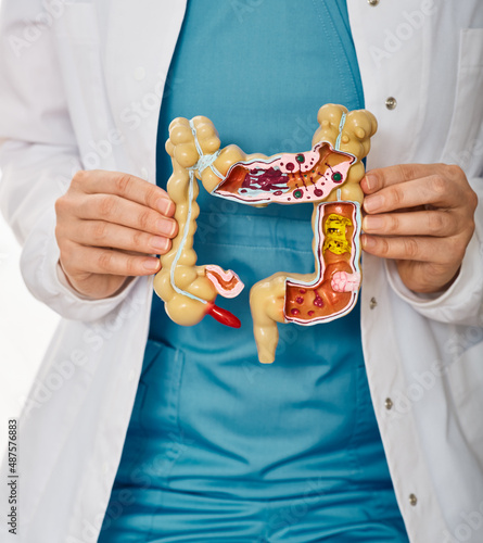 Treatment of colitis, flatulence, indigestion in healthcare. Anatomical intestines model with pathology in doctor hands, close-up photo