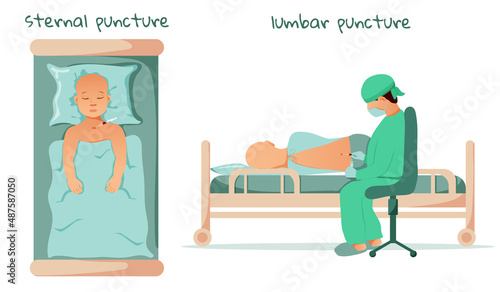 Sternal puncture and Lumbar puncture. Cancer treatment