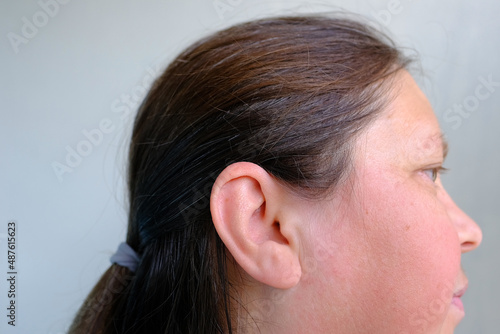 close-up of face of adult woman in profile, sore ear, concept of health care, hearing organs health, prevention of otitis media and hearing loss, World Hearing Day