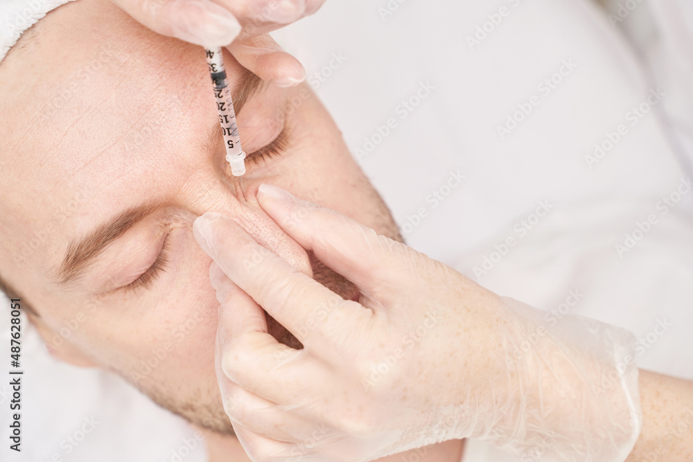 Injection at spa salon. Doctor hands in gloves. Closeup. Pretty male patient. Beauty treatment. Healthy skin procedure. Young man face. Plasmolifting rejuvenation Injection at spa salon. Doctor hands in gloves. Closeup. Pretty male patient. Beauty treatment. Healthy skin procedure. Young man face. Plasmolifting rejuvenation