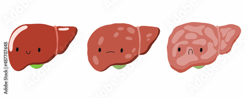 Liver disease. Sick and healthy liver character. Cirrhosis, hepatitis, fatty liver. Stock vector cartoon illustration on a white background.