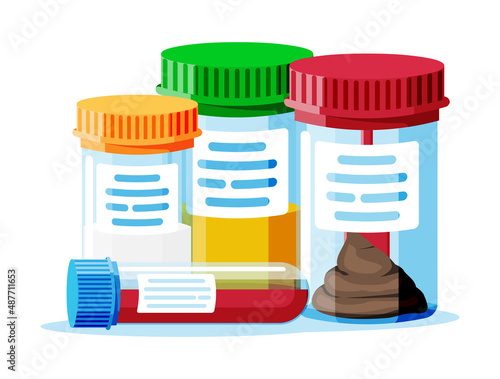 Test Tubes with Caps. Stool, Blood, Urine, Sperm.