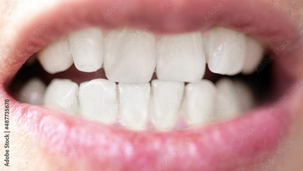 Closeup of a man teeth before and after whitening. Health teeth