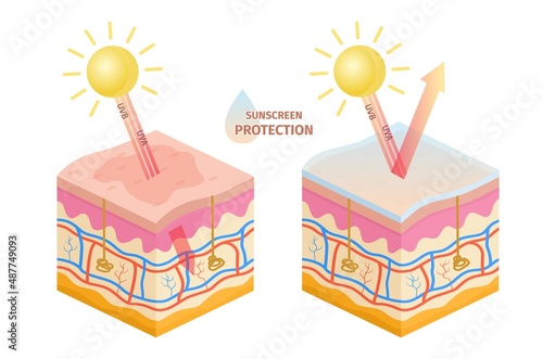 Human skin uv rays protection, before and after sunscreen. Sun uva, uvb epidermis damage prevention lotion. Skin sunburn vector infographic