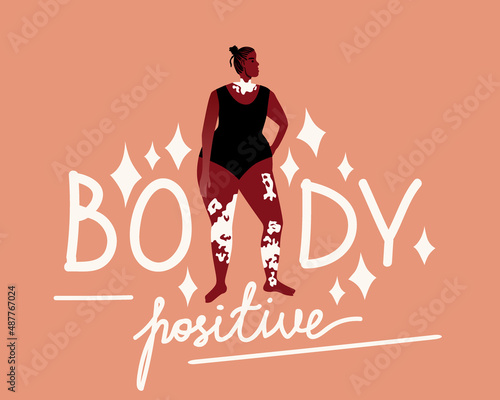 Lettering with body text positive, attractive African woman with spot on black skin, flat vector stock illustration with vitiligo disease
