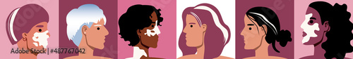 Different women with vitiligo skin as collage, flat vector stock illustration with depigmentation appearance photo