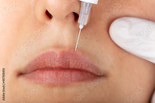 Young lady getting injections for bigger, fuller lips. The woman in the beauty salon. Plastic surgery clinic.
