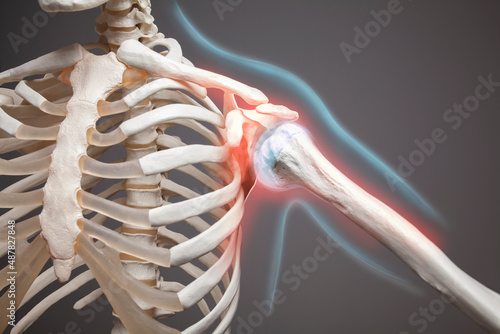 Shoulder pain neuralgia, chest muscle, human skeleton anatomy illustration