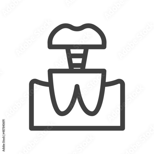 Dental pin icon. A simple line drawing of treating a tooth by twisting the second half of the tooth into the part with the root. Isolated vector on white background.