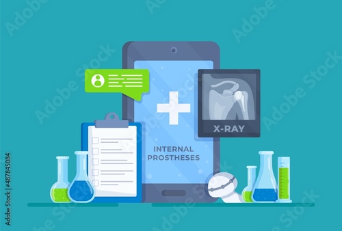 Vector illustration of internal prostheses. Clavicle Prosthesis. X-ray. Health insurance.