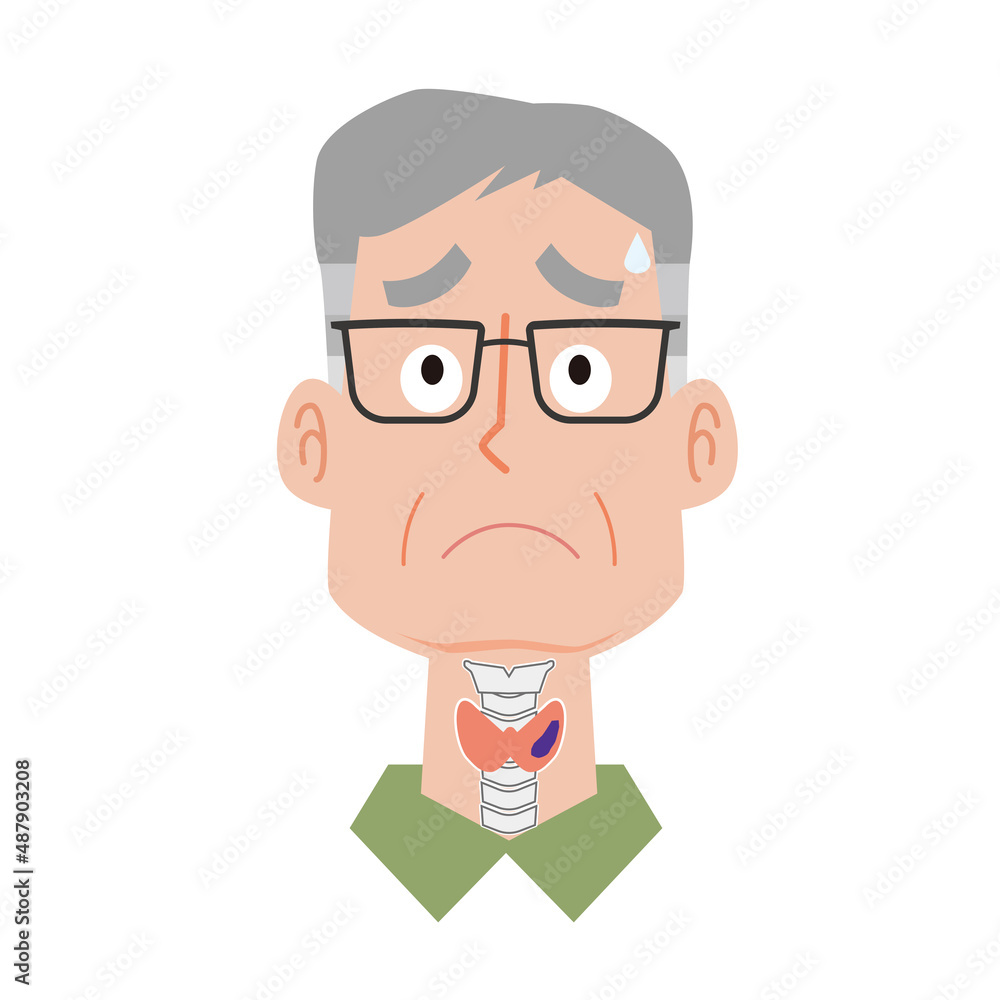 甲状腺がんの中年男性 甲状腺がんの中年男性